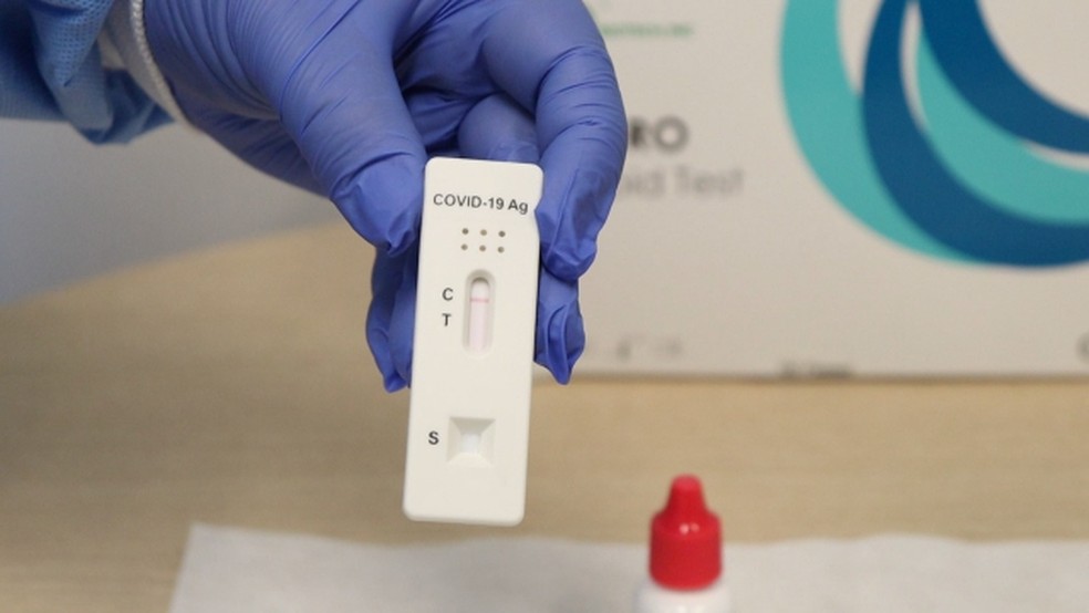 Teste rápido para detecção de antígeno Covi-19 - Foto: Fábio Marchetto/Divulgação
