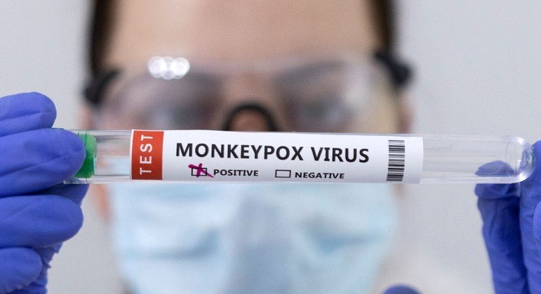 Diagnóstico da varíola do macaco é feito por meio da análise de amostras das lesões da pele REPRODUÇÃO/REUTERS
